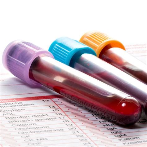 laboratóriumi tisztasági vizsgálat és minőségellenőrzés ábrázolása