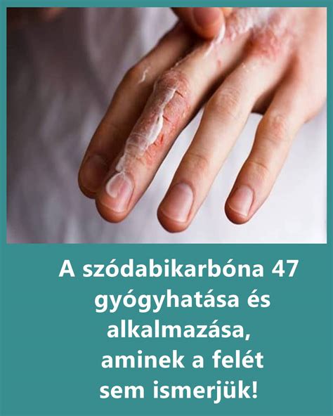 szódabikarbóna és hidrogén-peroxid alkalmazása