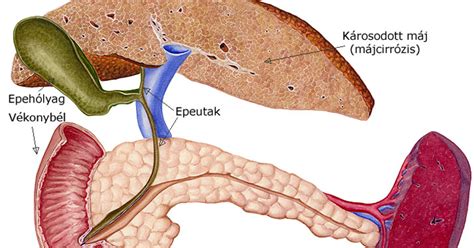 A máj tisztításának lépései: epe és erek eltávolítása