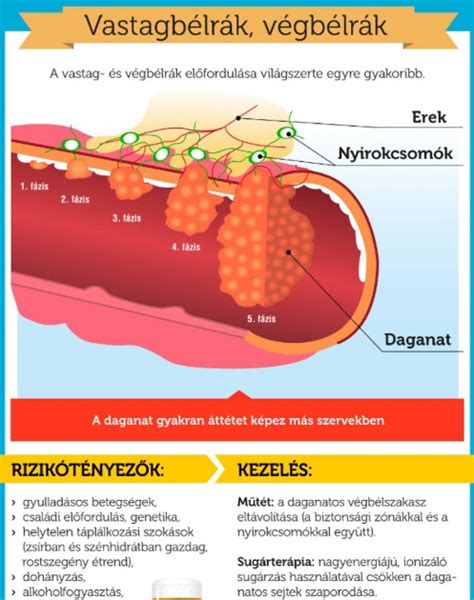 Bőrgyulladás a végbél környékén