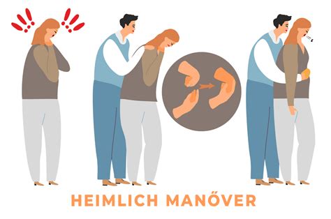 Heimlich-fogás bemutatása