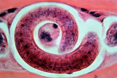 Trichinella lárva az izomszövetben