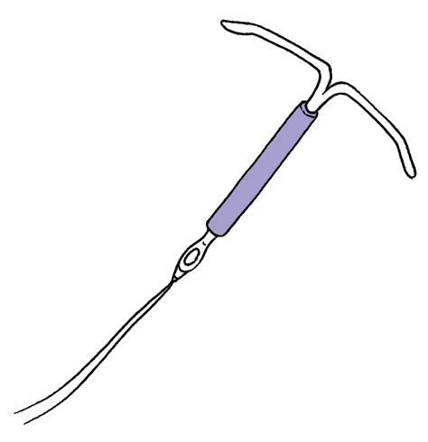 Az IUD ellenjavallatai