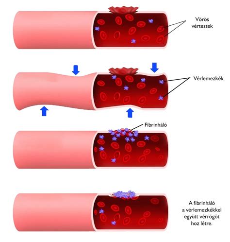 A véralvadás folyamata