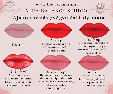 Herpesz hólyagok gyógyulási folyamata