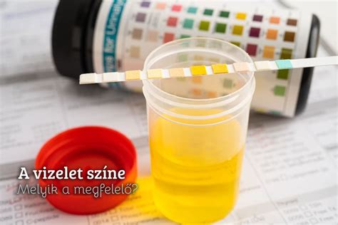 A vizelet színskálája és az egészségi állapot összefüggései
