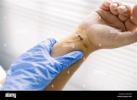 Doctor examining a wound