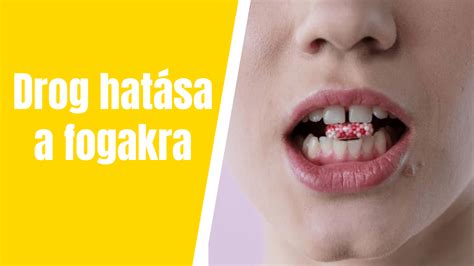 A különböző állagú rágcsálnivalók hatása a fogakra