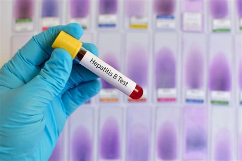 A hepatitis A vírus terjedési módjai