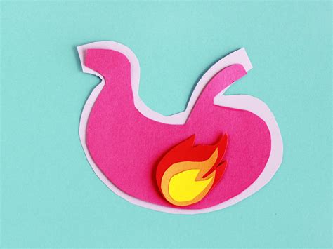 Reflux és gyomorégés illusztrációja