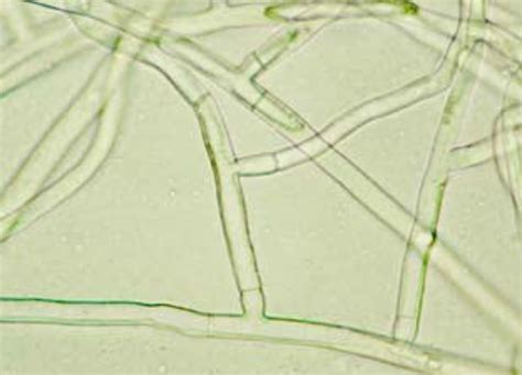 A Rhizoctonia solani gomba életciklusa