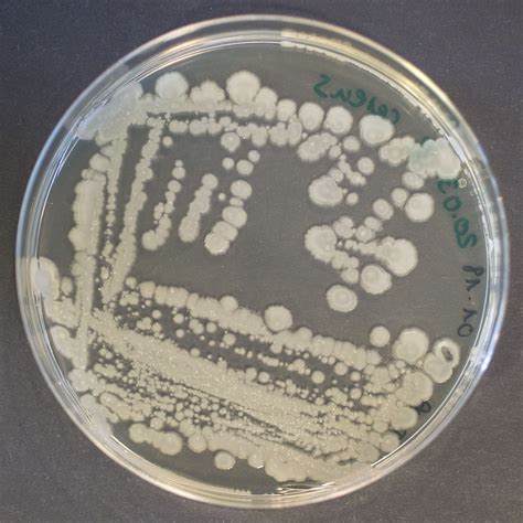 A Bacillus cereus baktérium mikroszkopikus képe