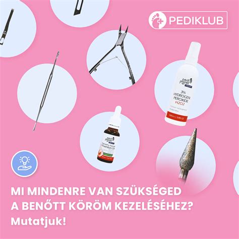 Otthoni kezelési tippek benőtt körömre