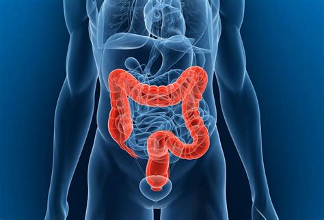 A Crohn-betegség által érintett bélrendszer