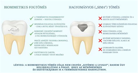 Biomimetikus tömés fogon