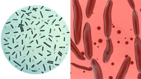 Clostridium botulinum baktérium