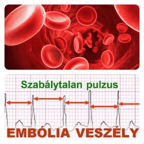 Töltésátadás vezetéssel