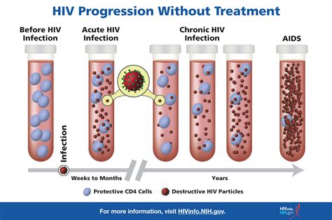 A HIV fertőzés stádiumainak diagramja