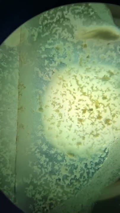 brokkoli és baktériumok mikroszkóp alatt