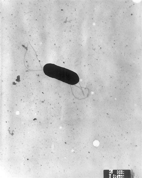 Listeria monocytogenes baktérium mikroszkopikus képe