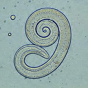 Trichinella lárvák mikroszkópos képe izomszövetben