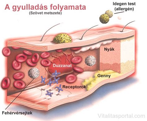 A gyulladás folyamata