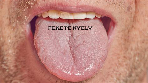 A nyelv reflexzónáit bemutató térkép