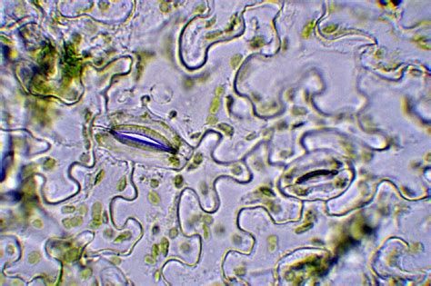 Schistosoma peték mikroszkópos képe