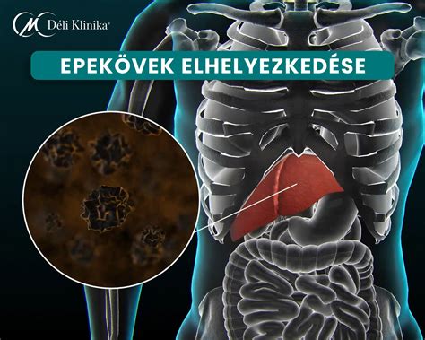 Epekő elhelyezkedése diagram