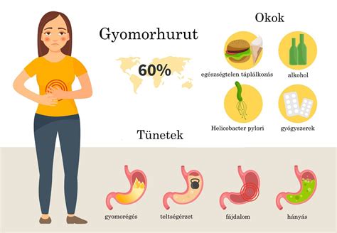 A gyomorfekély és gyomorhurut közötti különbségek