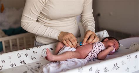Újszülött köldökcsonk pelenkázási tippekkel
