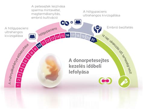 Az IVF folyamatának lépései infografika