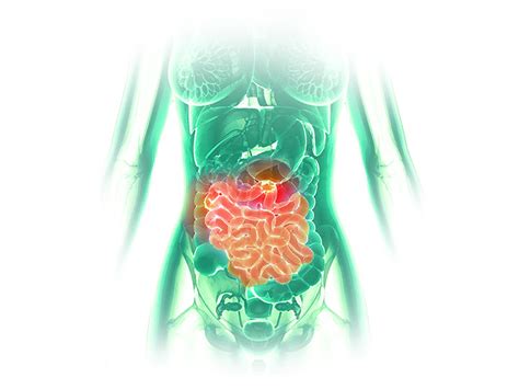 Illusztráció a bélflóráról
