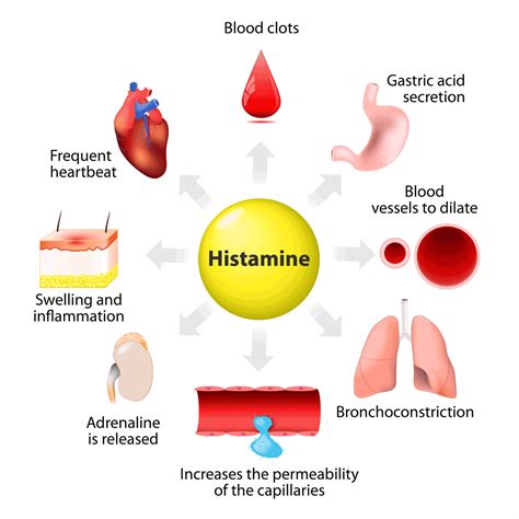 hisztaminintolerancia diagram