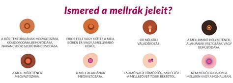 A férfi mellrák tünetei