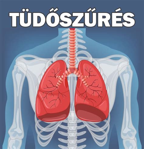 Tüdőszűrés fontossága infografika