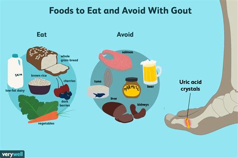 Gout diet infographic