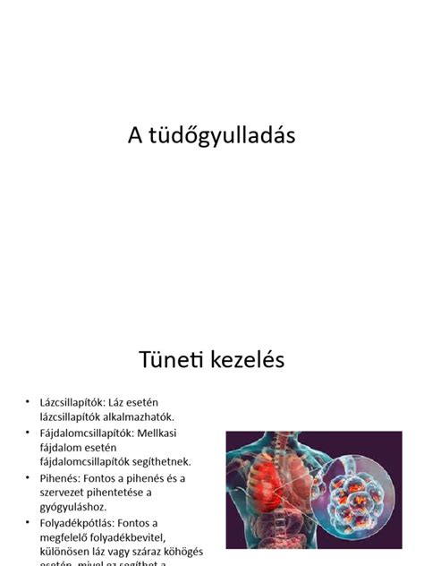 A tüdőgyulladás kórokozóinak típusai