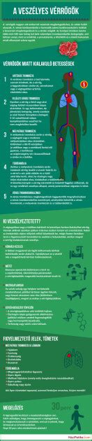 A kuplungkopás jelei infografika