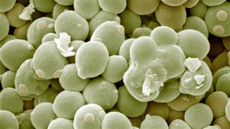 Saccharomyces cerevisiae élesztősejtek mikroszkopikus képe