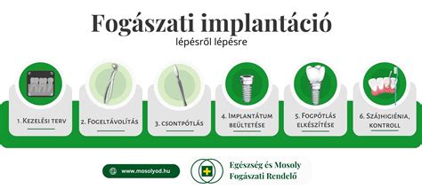 Online rendelési folyamat lépésről lépésre