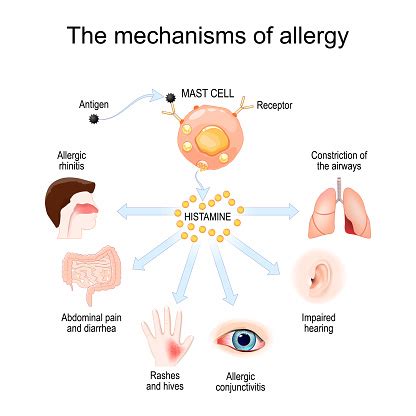 Allergiás reakció mechanizmusa