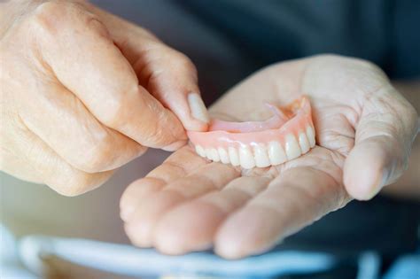 Műfogsor illeszkedési problémáit illusztráló képek