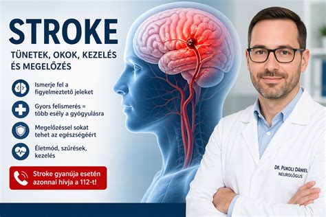 A stroke kockázati tényezőit és megelőzését bemutató ábra