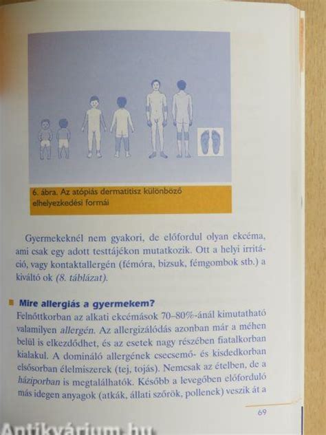 Gyermekkori allergiák kinövése