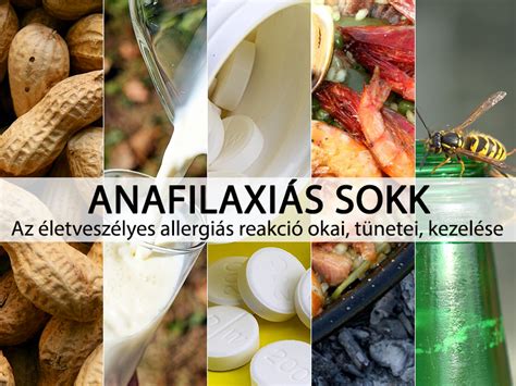 Anafilaxia kezelése