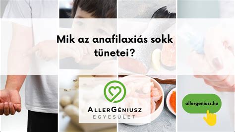 Anafilaxiás reakció tünetei